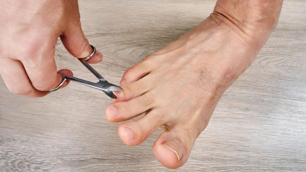 A man trimming his toenails.