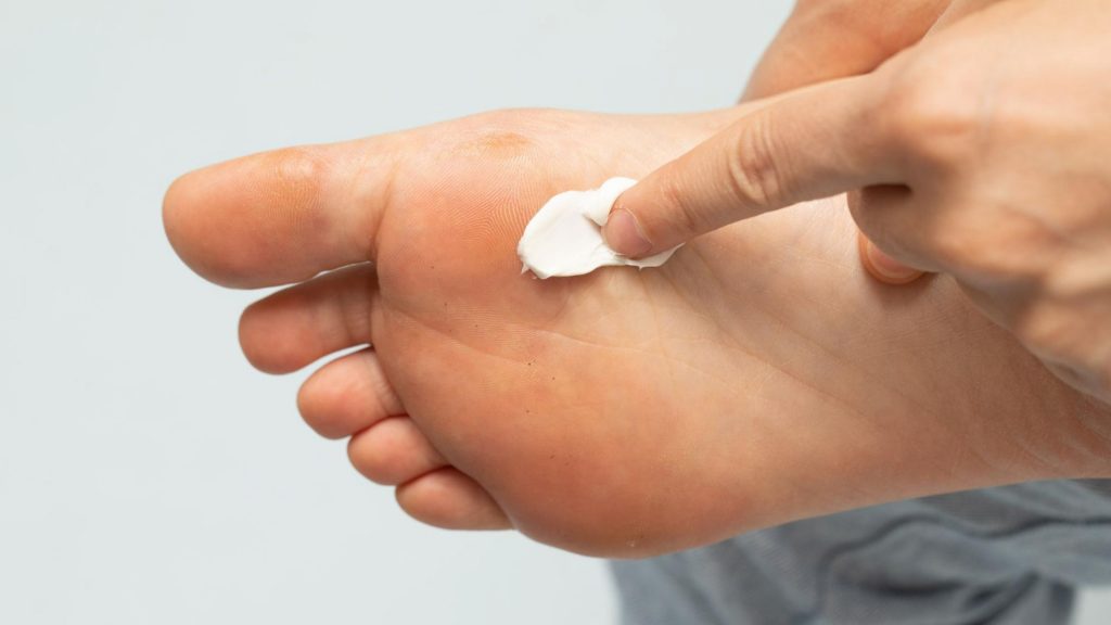 A person applying moisturizing cream on foot.